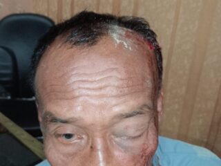 Dianiaya Tetangga Pakai Gagang Tembilang Hingga Babak Belur, Warga Pangean Lapor Polisi