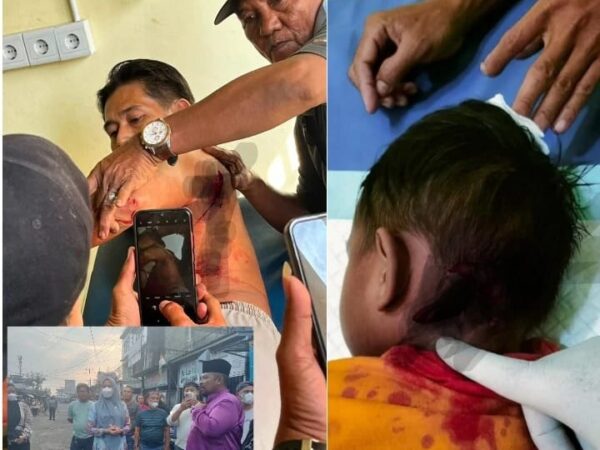 Breaking News: Korban Gigitan Monyet Liar di Inhil Bertambah Jadi 15 Orang, Seorang Anak Digigit di Bagian Leher